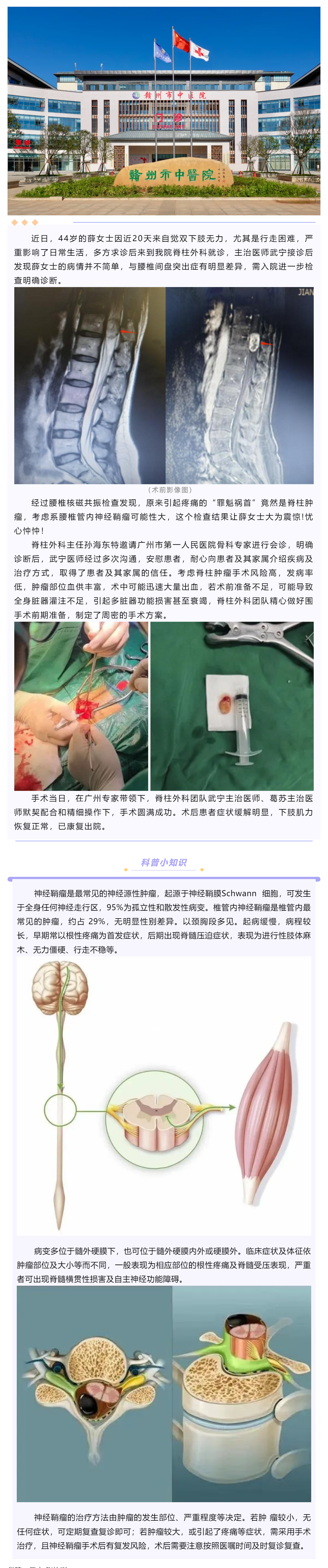 腰腿痛、下肢乏力麻木，提防神經(jīng)鞘瘤！.png