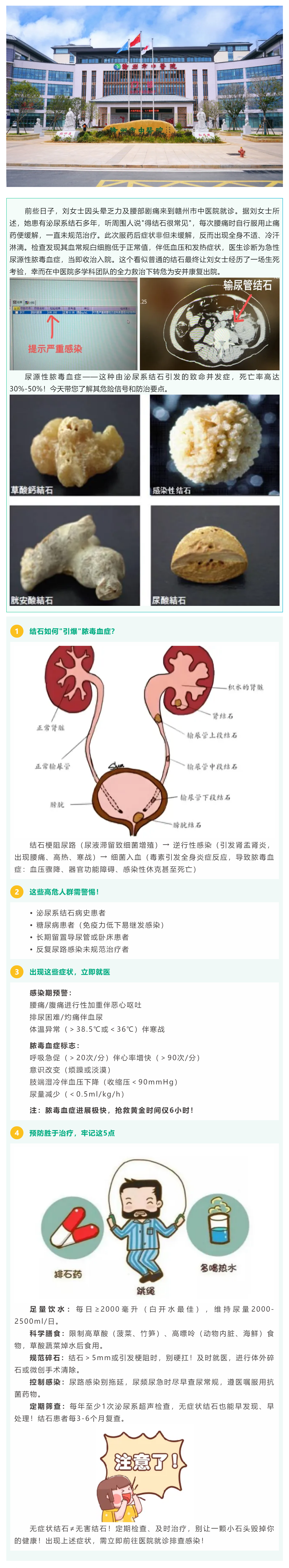 沉默的結(jié)石，暗藏的_致命危機(jī)_——警惕尿源性膿毒血癥！.png