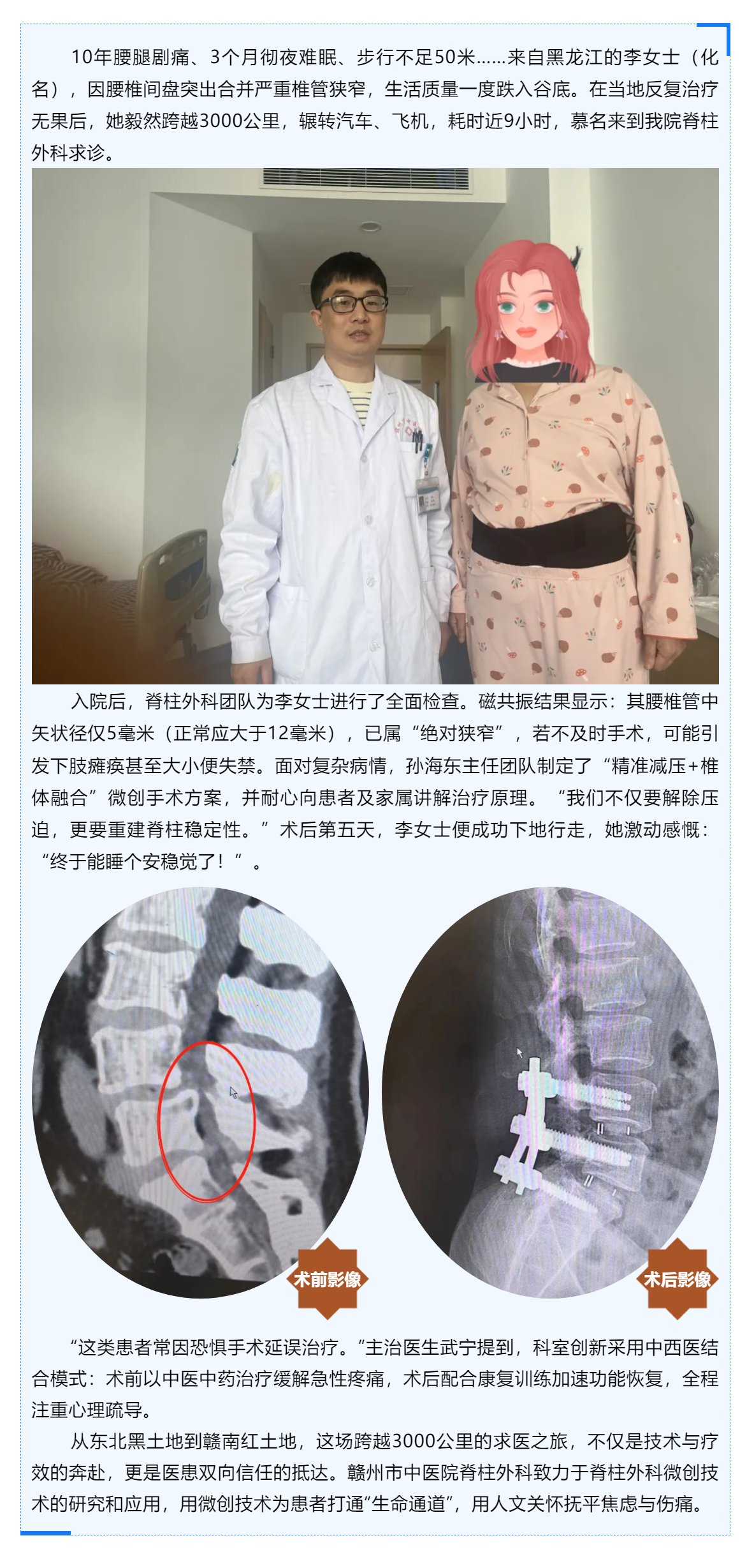 跨越山河的信任_贛州市中醫(yī)院巧手“疏堵”，腰椎狹窄患者3000公里求醫(yī)路終迎新生！.png