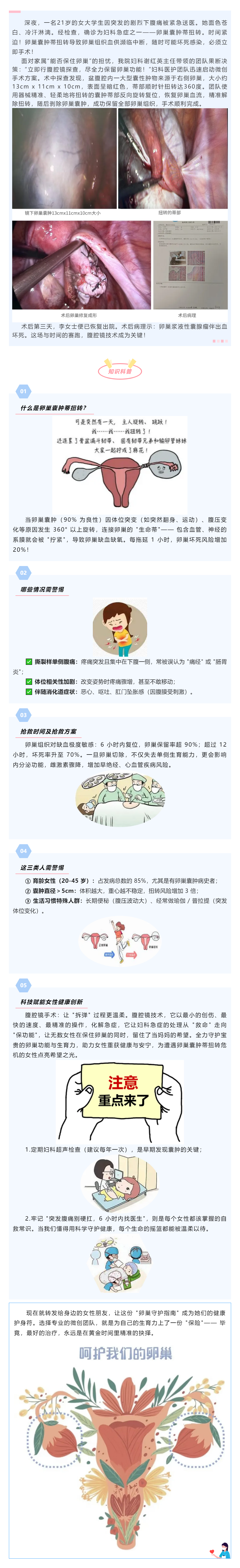 【科普】卵巢囊腫蒂扭轉(zhuǎn)——不可忽視的“婦科急腹癥”.png